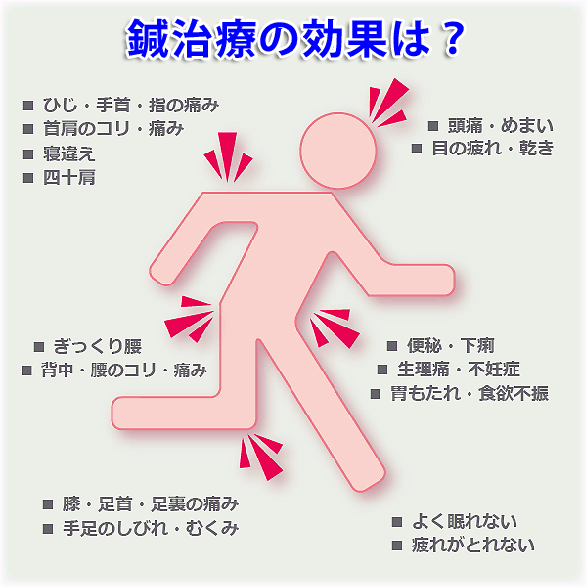 鍼療法の効果とは？