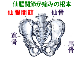 仙腸関節が痛みの根本