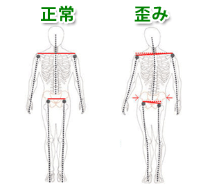 骨盤の正常