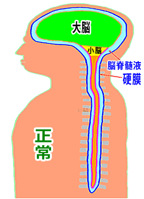 正常な状態