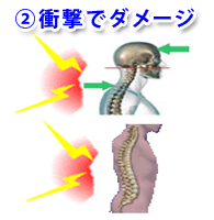 ②衝撃でダメージ